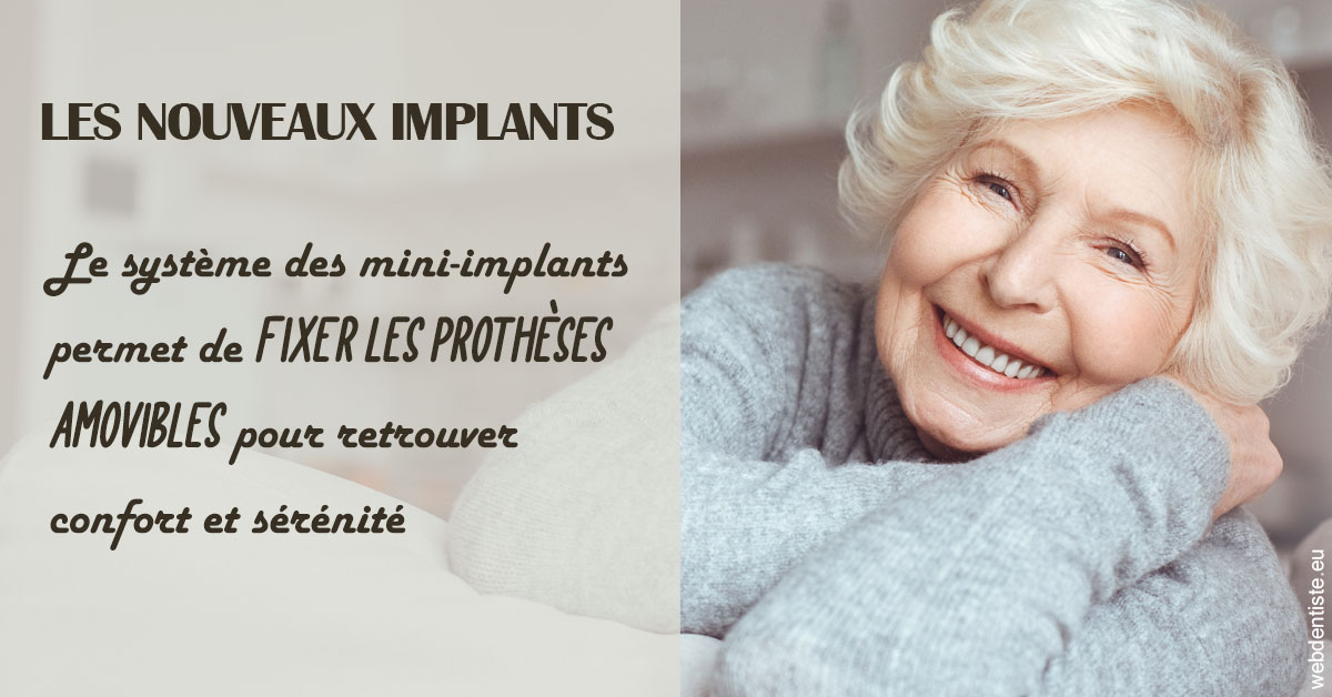 https://dr-dehay-dorothee.chirurgiens-dentistes.fr/Les nouveaux implants 1