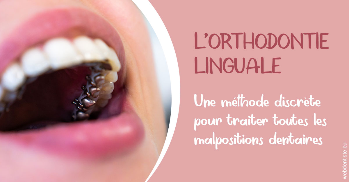 https://dr-dehay-dorothee.chirurgiens-dentistes.fr/L'orthodontie linguale 2