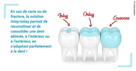 https://dr-dehay-dorothee.chirurgiens-dentistes.fr/L'INLAY ou l'ONLAY