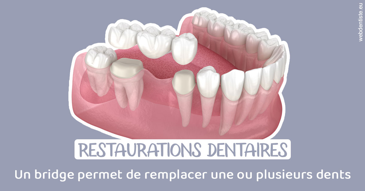 https://dr-dehay-dorothee.chirurgiens-dentistes.fr/Bridge remplacer dents 1