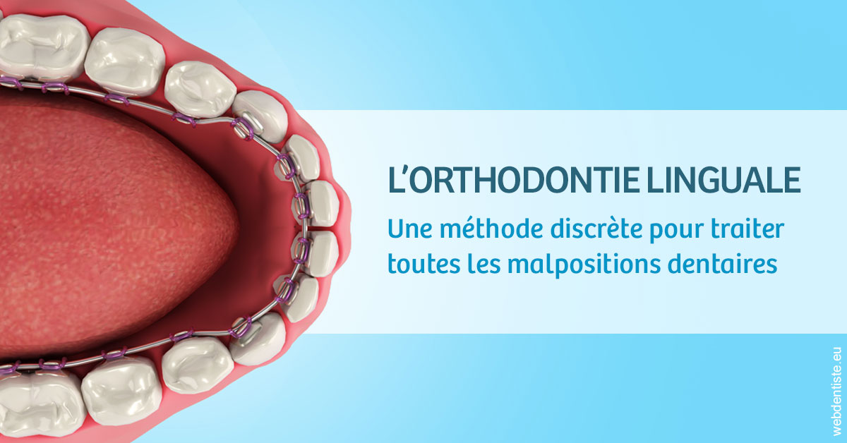 https://dr-dehay-dorothee.chirurgiens-dentistes.fr/L'orthodontie linguale 1
