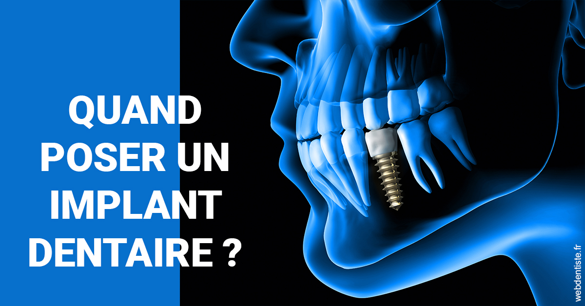 https://dr-dehay-dorothee.chirurgiens-dentistes.fr/Les implants 1
