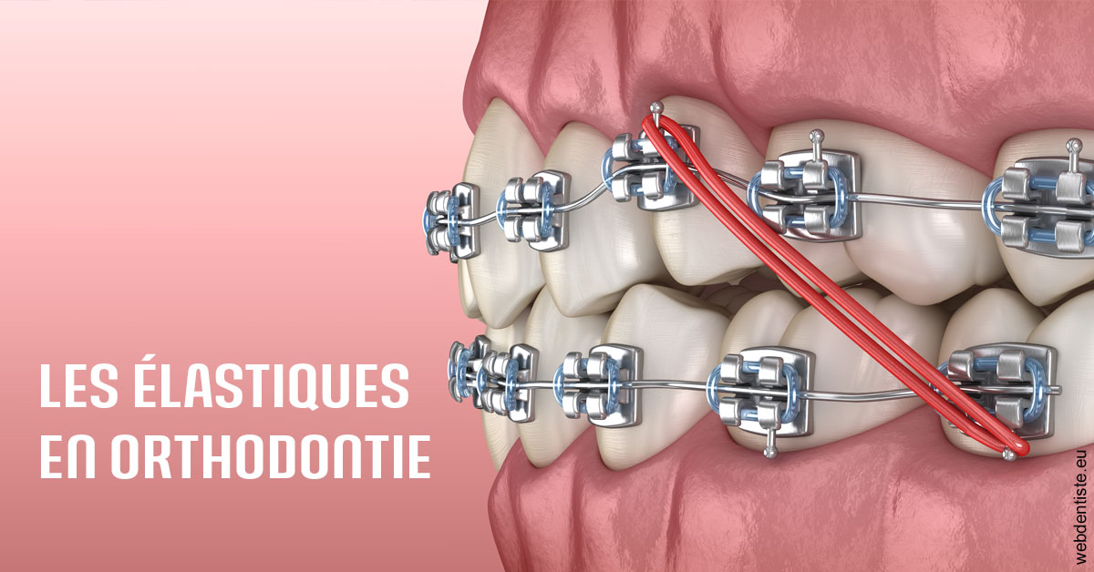 https://dr-dehay-dorothee.chirurgiens-dentistes.fr/Elastiques orthodontie 2