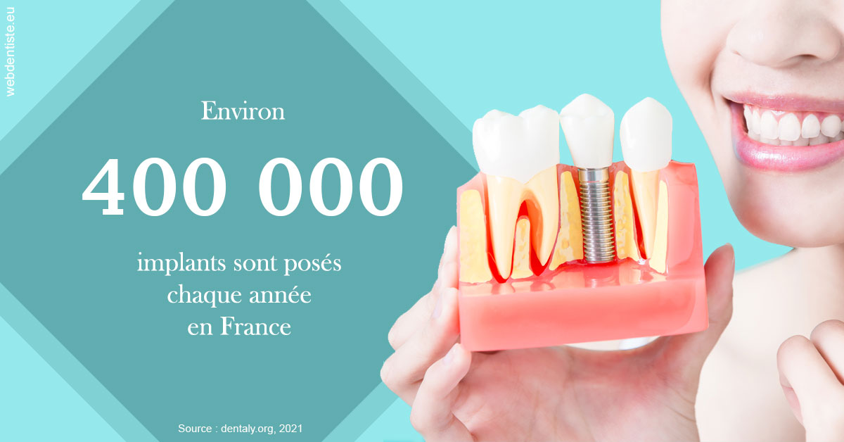 https://dr-dehay-dorothee.chirurgiens-dentistes.fr/Pose d'implants en France 2